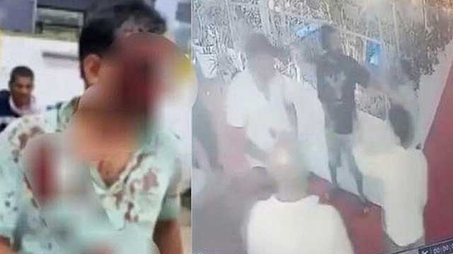 बदमाशों के हौसले कितने बुलंद, होटल मैनेजर पर जानलेवा हमला बदमाशों के हौसले कितने बुलंद, होटल मैनेजर पर जानलेवा हमला