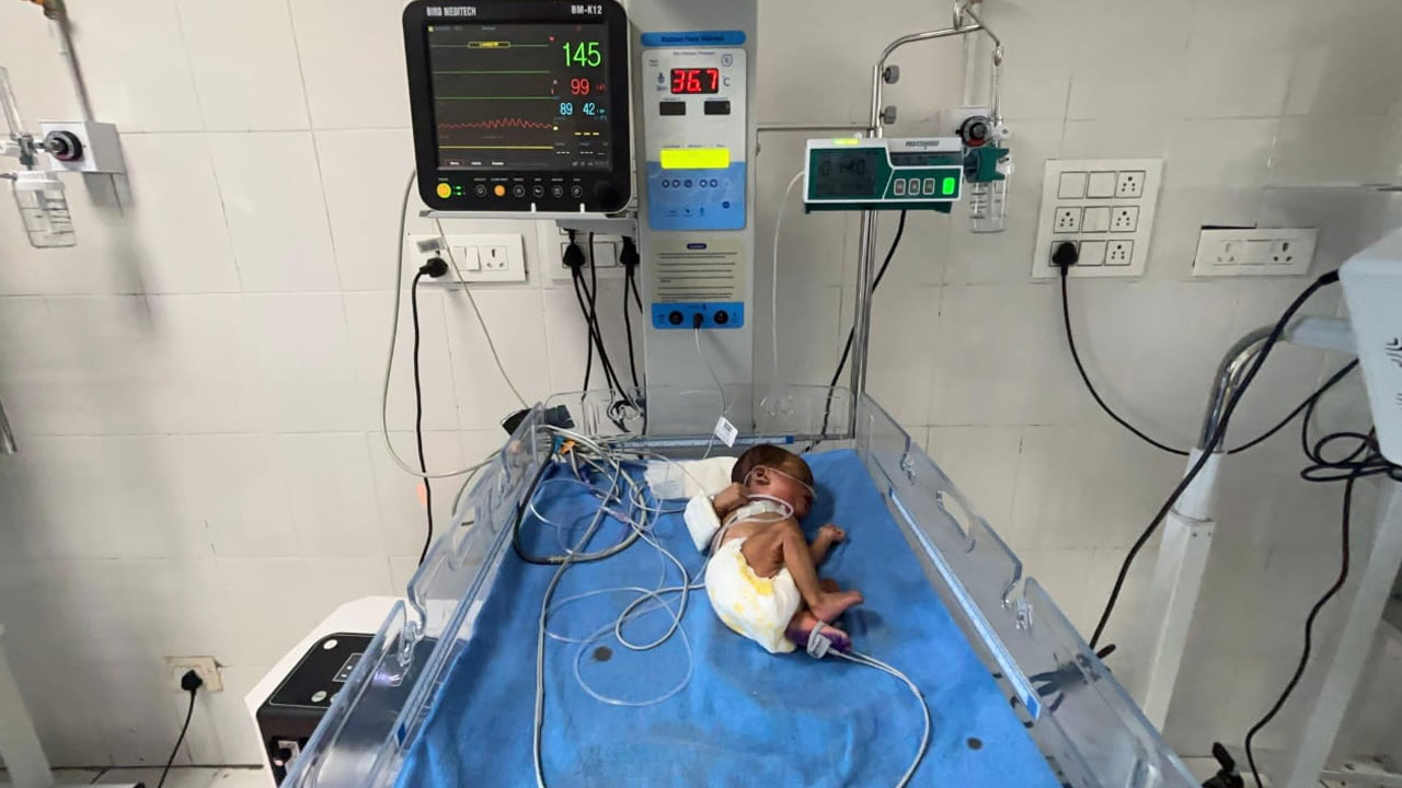 Coronation SNCU Ward